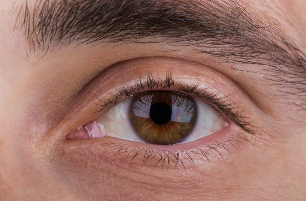 An extreme close-up of a healthy human eye with a brown iris, used to illustrate the area affected by wet AMD.